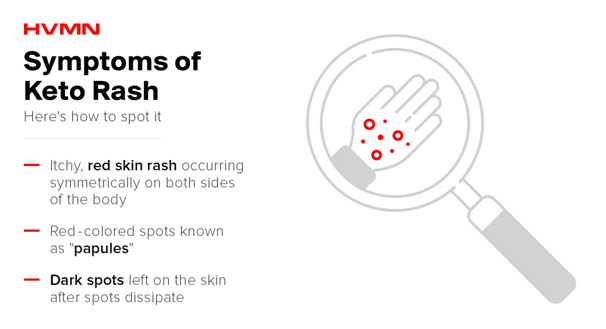 This image describes symptoms of keto rash including itchy red skin rashes, red-colored spots, and dark spots left on the skin after spots dissipate